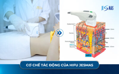 Cách chọn máy hifu phù hợp cho Spa